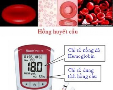 Máy đo Hemoglobin